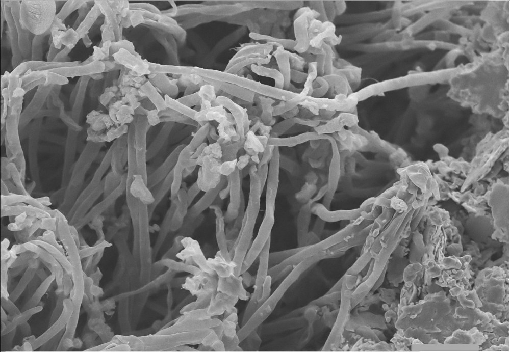 51813447_2316066768625506_474312479950766080_o